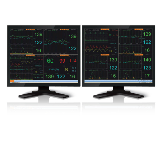 2800 Multi-Parameter Central Monitoring System